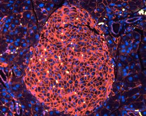 Immunofluorescence image of a paraffin-embedded pancreas section stained with antibodies