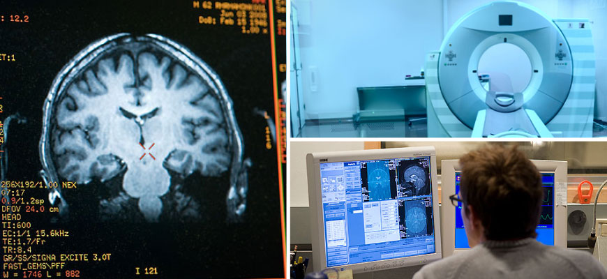 Photo collage of a brain scan, MRI machine and analysist